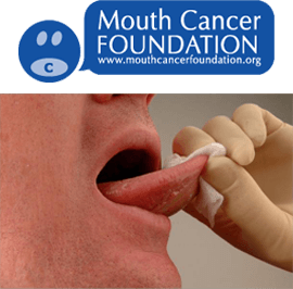 Mouth Cancer Soft Tissue Exam